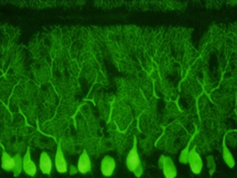 免疫组织化学服务